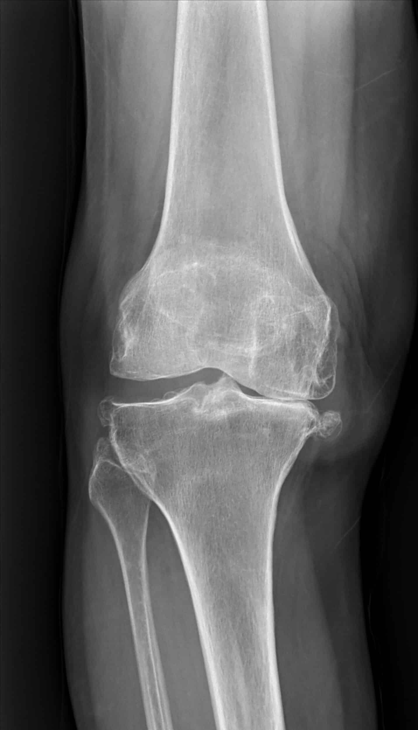 Figure2Right scaled
